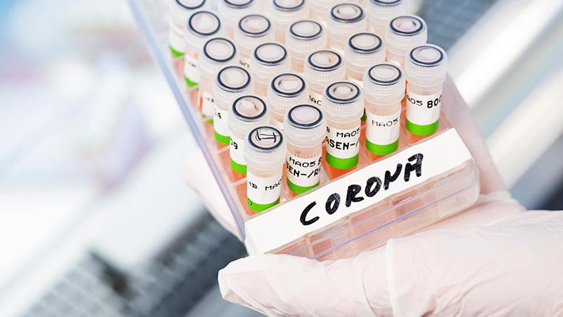Corona-PCR-Tests